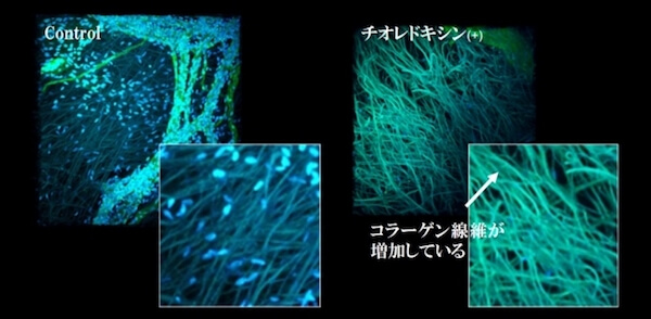 Japan｜ファンケルが「チオレドキシン」に皮膚内部の線維構造を改善する効果があることを発見